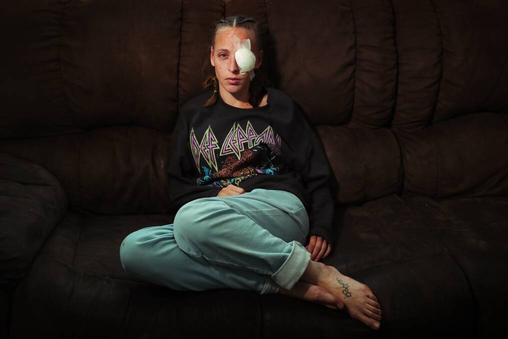 Carissa Edwards is pictured recovering at home on Thursday, October 5. Picture: Sylvia Liber